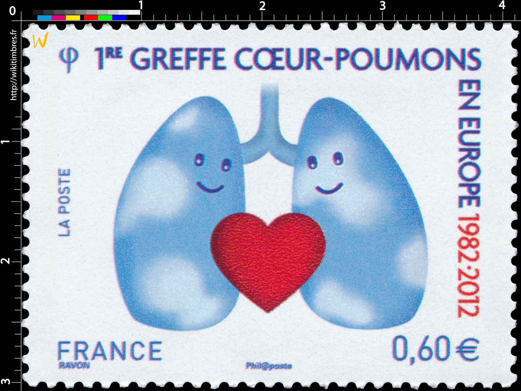 1re greffe cœur-poumons en Europe 1982 - 2012
