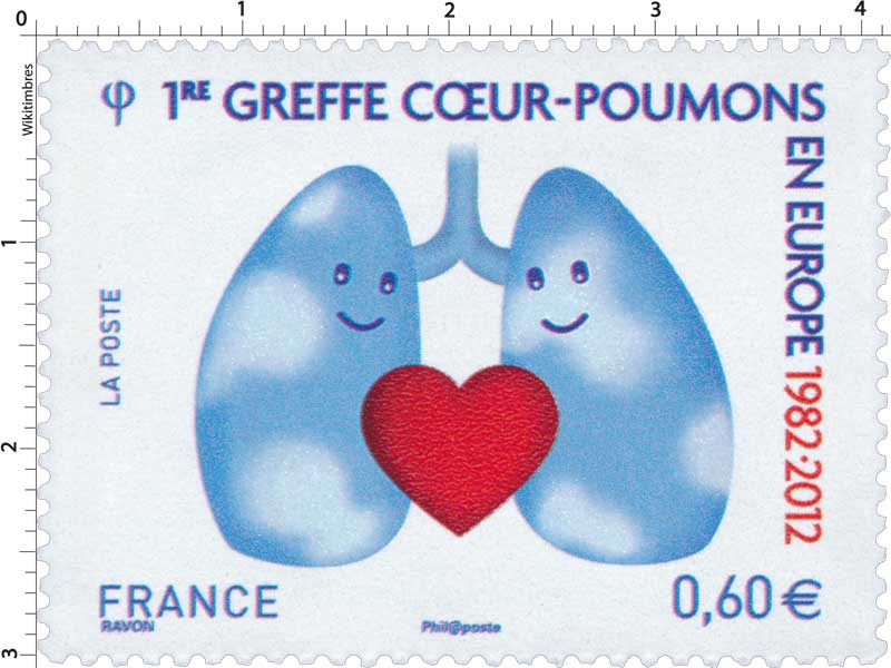 1re greffe cœur-poumons en Europe 1982 - 2012